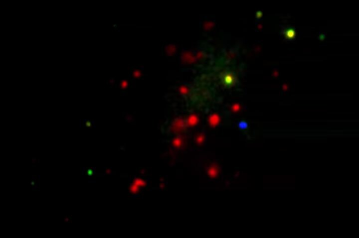 細胞内で発現している遺伝子をリアルタイムに顕微鏡で観察することが可能に   UMass Medical School-YouTube