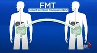 世界で進む「糞便移植」が日本で普及していない理由