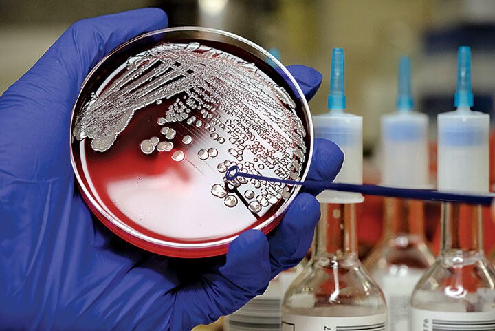 抗生物質が効かなくなった菌から身を守るにはどうすればいいのか　RODOLFO PARULAN JRーMOMENT／GETTY IMAGES