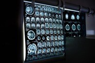 【写真】10代の少女が妊娠？ 心当たりないのに「どんどん膨らむお腹」写真を公開...診断は驚くべきものだった