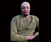 全身やけど、失明、片足を失っても...ウクライナ負傷兵たちが失わなかった「人間らしさ」