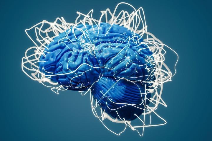 電気的な刺激で記憶力が回復......  magicmine -iStock