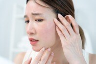 完全に「ホクロ」かと...医師も見逃した「皮膚がん」の写真がSNSで話題に、見分け方「ABCDEルール」とは？