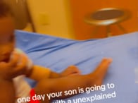 【写真】子供の指先に「不思議な痣」、危険な病気の症状だった...写真を公開した母親、「何かおかしいと直感した」