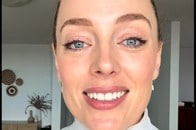 【動画】どこだか分かる？ この「できもの」、ニキビではなく皮膚がんだった...医師が「異常を察した」ポイントは？