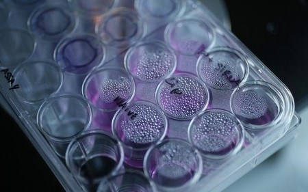 　４月３日、免疫療法といった新たながん治療薬の登場により患者の生存率は改善している一方で、薬価には競争原理が働かず、治療コストは年２５万ドルを上回る可能性もあるなど高額化の道をたどっている。写真はがん細胞の入った容器。ロンドンで２０１３年５月撮影（２０１７年　ロイター/Suzanne Plunkett）