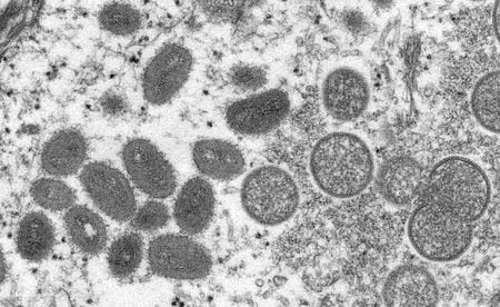 　欧州でサル痘の感染が広がっている。２０日には、ドイツやベルギー、フランス、オランダなどで初感染が報告され、欧州全域ではこれまでに１００人超の感染および感染疑い例が確認されている。写真はサル痘ウイルスの顕微鏡写真。CDCから１８日に提供（２０２２年　ロイター）