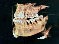 中国で歯の治療をしたら凄かった──逆メディカルツーリズム体験記