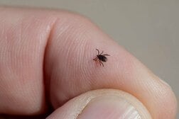 中国で新たなウイルス発見、媒介ダニは既に世界各地に…特に危険な重複感染、対策は？