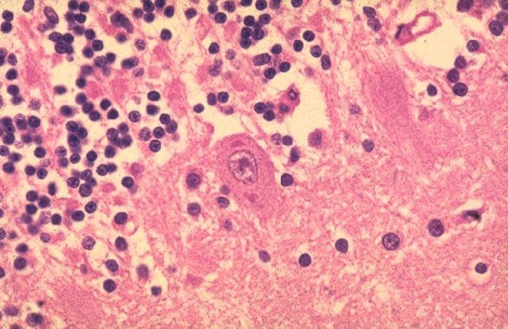 CDC/Dr. Makonnen Fekadu