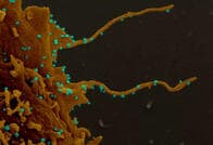 新型コロナが細胞に生やす不気味な触手の正体は