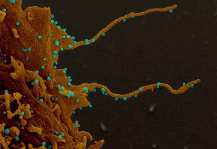 感染した宿主細胞とそこから伸びる触手　DR. ELIZABETH FISCHER, NIAID/NIH