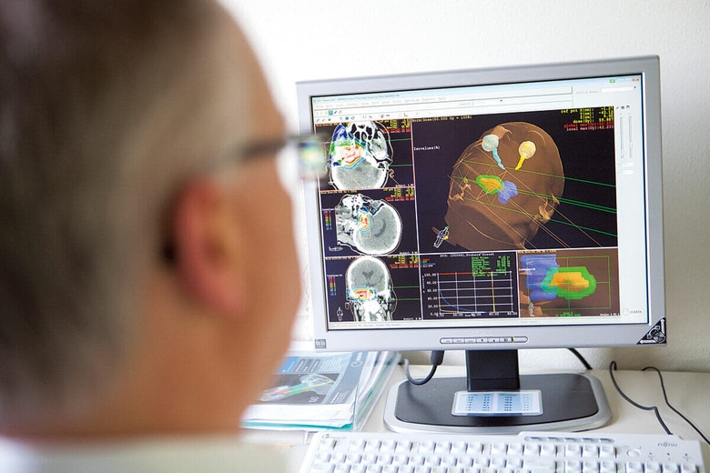 陽子線治療（写真）などの粒子線治療は正常組織にダメージを与えない　BSIPｰUNIVERSAL IMAGES GROUP/GETTY IMAGES