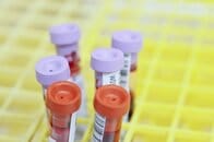 心臓病リスクを15年前に察知、AIを活用した最新の血液検査