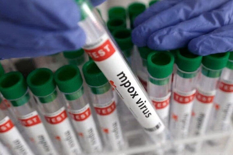 ドイツは、アフリカ大陸で感染が拡大するウイルス感染症エムポックス（サル痘）のワクチンを軍備備蓄から１０万回分提供する。写真は８月２０日撮影。Illustration提供（２０２４年　ロイター／Dado Ruvic）