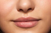 【写真】「鼻デカ」のあだ名を付けられた米女性、整形手術を受けるも結果に「大ショック」...術後の姿を披露