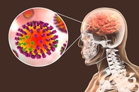 ウイルス感染がパーキンソン病やアルツハイマー病などの発症リスクを高めるおそれがあることがわかった