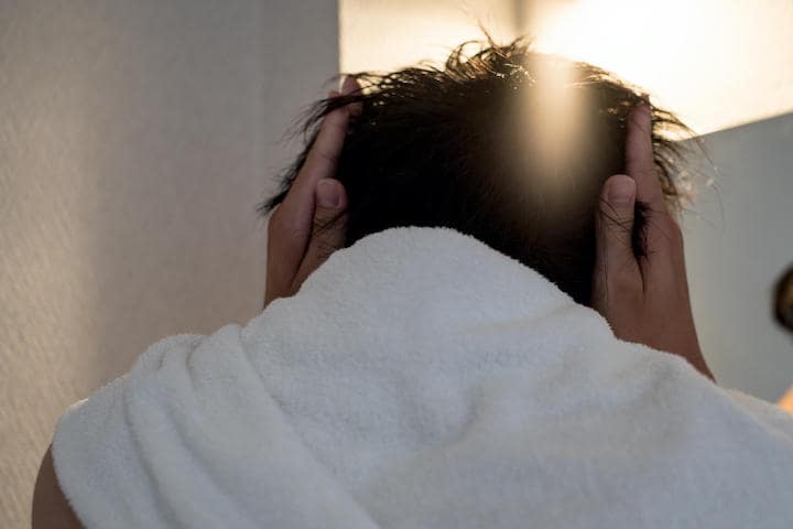 東アジアの男性は、脱毛率が世界でも最も低い状態が続いてきたが......  AH86-iStock