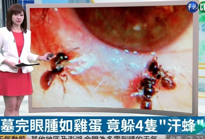 涙をタンパク源にしようとするハチがまぶたから４匹...... CTS Taiwan-Youtube