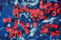 WHOが「エムポックス（サル痘）」緊急事態宣言...アフリカ大陸外ではスウェーデンで初確認される