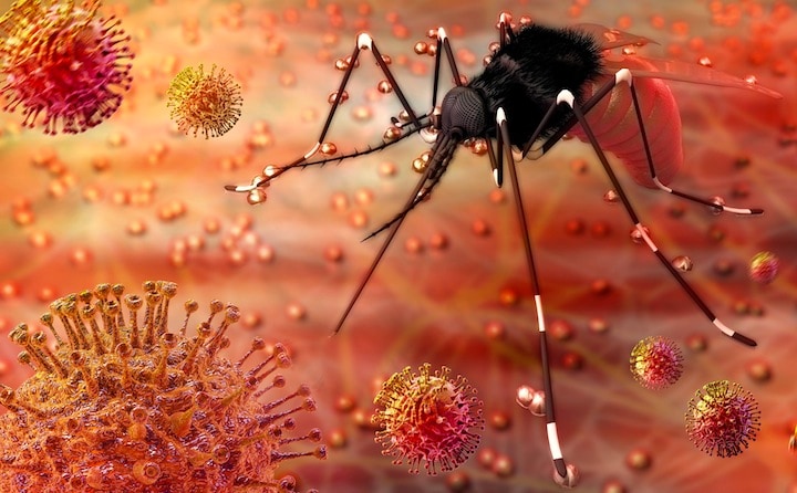 ジカ熱のウイルス、脳腫瘍の治療に光明か　（イメージ）nopparit-iStock