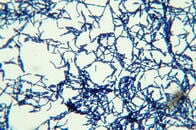 線虫の腸内微生物叢から、薬剤耐性菌に効果的な新しい抗生物質が発見される