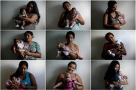 「ジカ熱、水無脳症の原因にもなる可能性」エール大の研究チームが警告