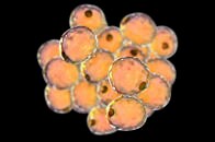 乳がん細胞を脂肪細胞に変えることに成功：バーゼル大学の研究