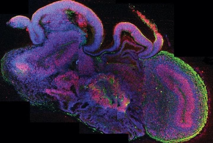 進化著しい人工脳「脳オルガノイド」　　Madeline A Lancaster/IMBA/EPA