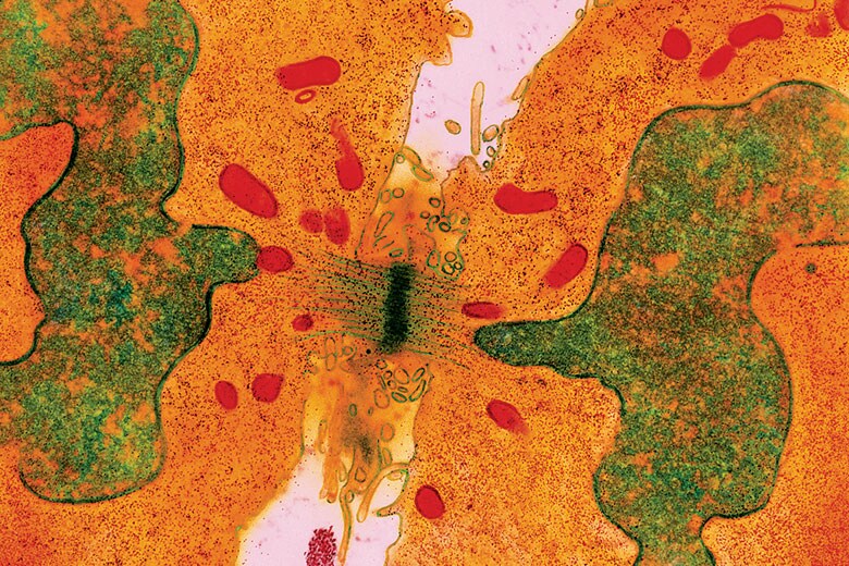 現在の治療は基本的に、癌細胞の分裂を抑制することを目指す　STEVE GSCHMEISSNER-SCIENCE PHOTO LIBRARY/GETTY IMAGES