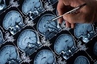 心肺停止後、5分は意識がある！？　最新の脳神経学で分かった「死」