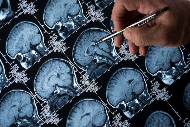 心肺停止後、5分は意識がある！？ haydenbird-iStock