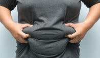 肥満と脳の萎縮に相関関係があった──認知症対策に使えるかも？