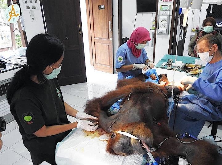 鎖骨骨折の手術跡も痛々しいオランウータン「HOPE」。(c) Sumatran Orangutan Conservation Programme (SOCP) via Facebook