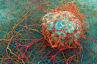 癌細胞を確実に攻撃する「魔法の弾丸」（米ミズーリ大学研究）