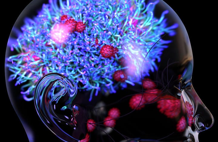 脳の画像検査などさらなる研究が待たれる　Design Cells-iStock