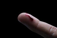 10年以内の死亡率を予測できる血液中のバイオマーカーが特定される