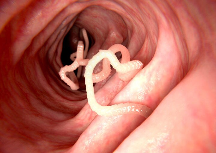 腸内のサナダムシ　selvanegra/iStock.