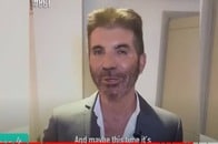 【写真】美容整形を受けた男性セレブたち