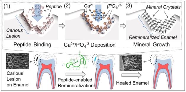 toothschematic1.jpg
