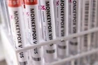 米CDC、サル痘の市中感染例を確認　寝具やタオル共有する家族間で広がる