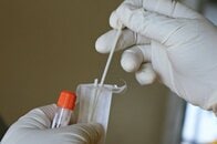 「唾液」でがんの兆候を検出？ 口内細菌に早期発見の手がかり