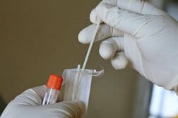 「唾液」でがんの兆候を検出？ 口内細菌に早期発見の手がかり