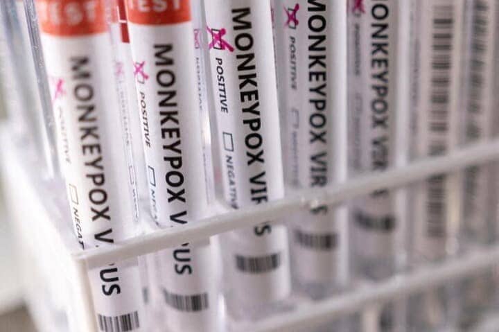 米疾病対策センター（ＣＤＣ）は、天然痘に似た感染症「サル痘」について、海外渡航歴のある人の感染報告以外に市中感染例も確認されていると明らかにした。写真はイメージ。５月撮影（２０２２年　ロイター／Dado Ruvic）